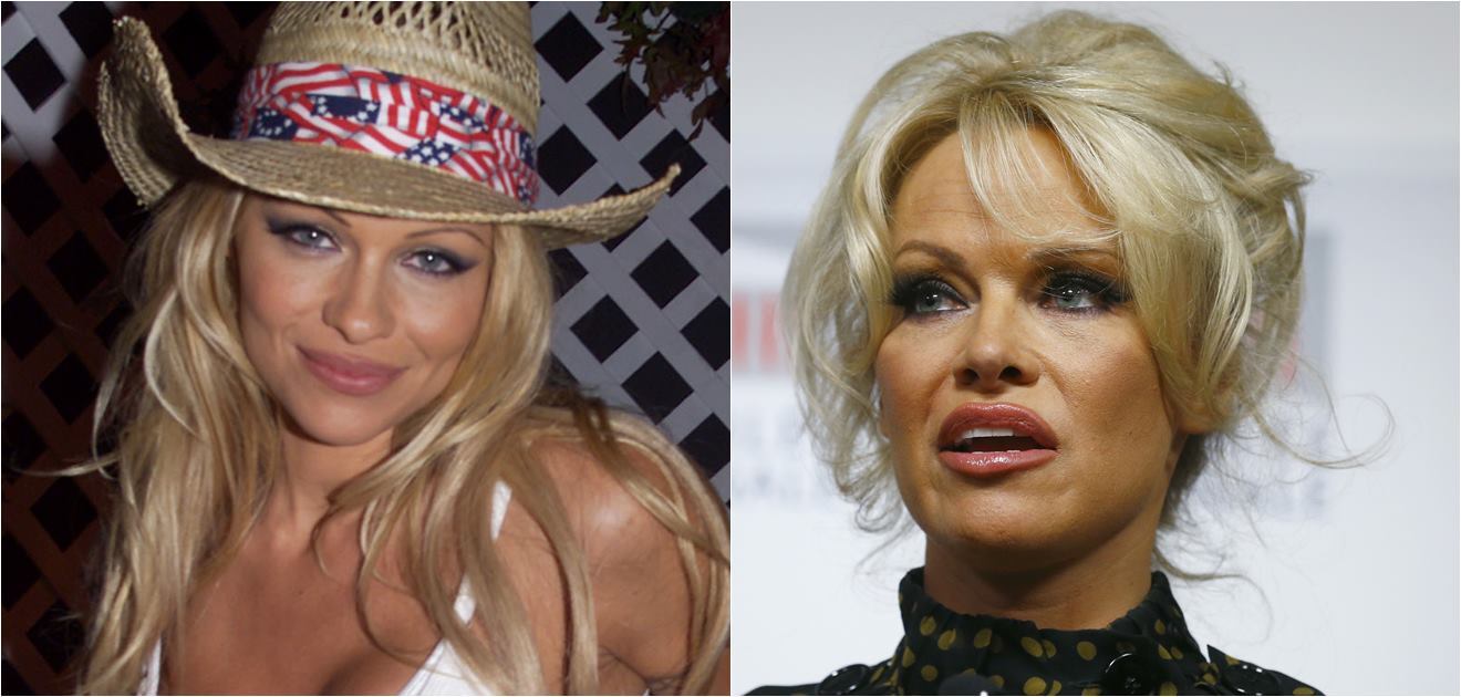 Las actrices de los 90 que se cambiaron el rostro 