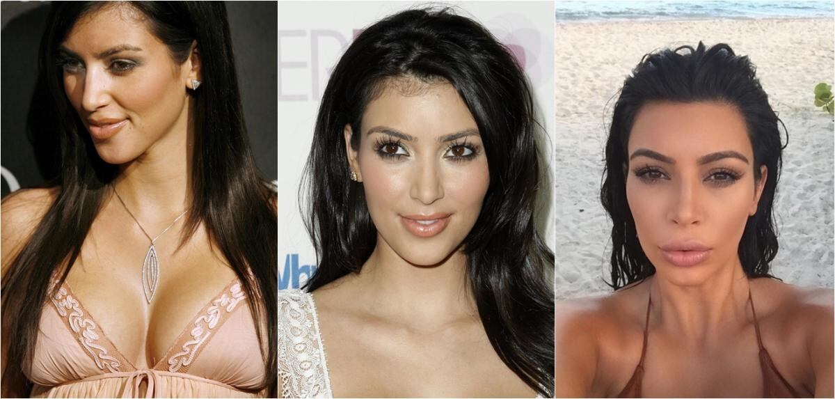 La transformación del rostro de Kim Kardashian 
