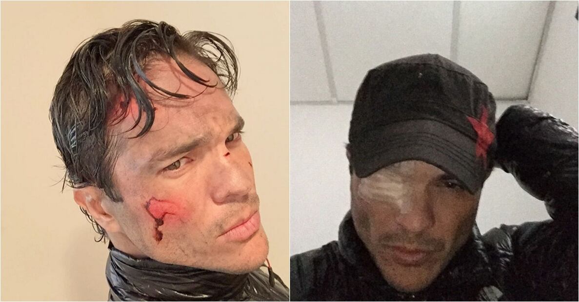 Famosos que salieron heridos mientras grababan