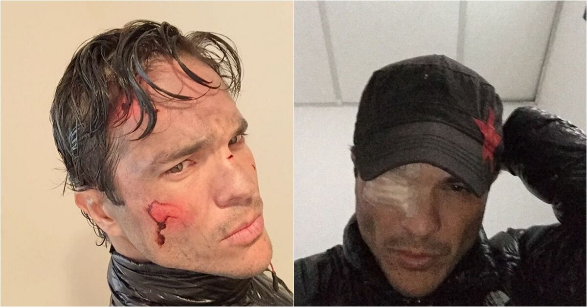 Famosos que salieron heridos mientras grababan