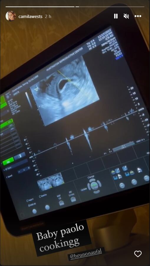 Camila West, hija de Amparín Serrano, está embarazada de nuevo 