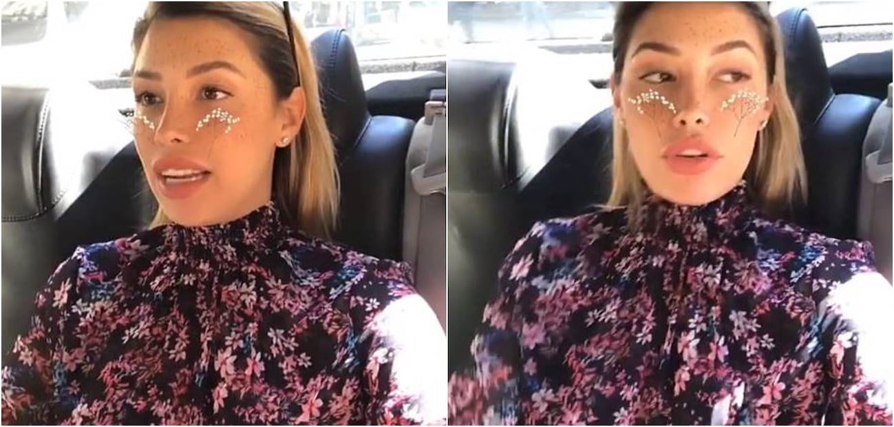Sorprende Michelle Salas con nuevos labios
