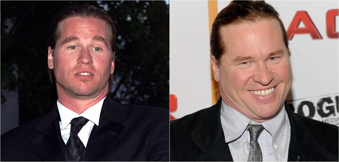 Famosos que envejecieron mal