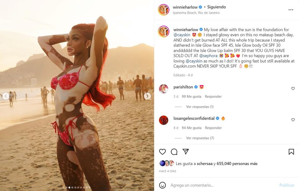 Winnie Harlow luce su increíble figura con mini bikini en la playa de Brasil