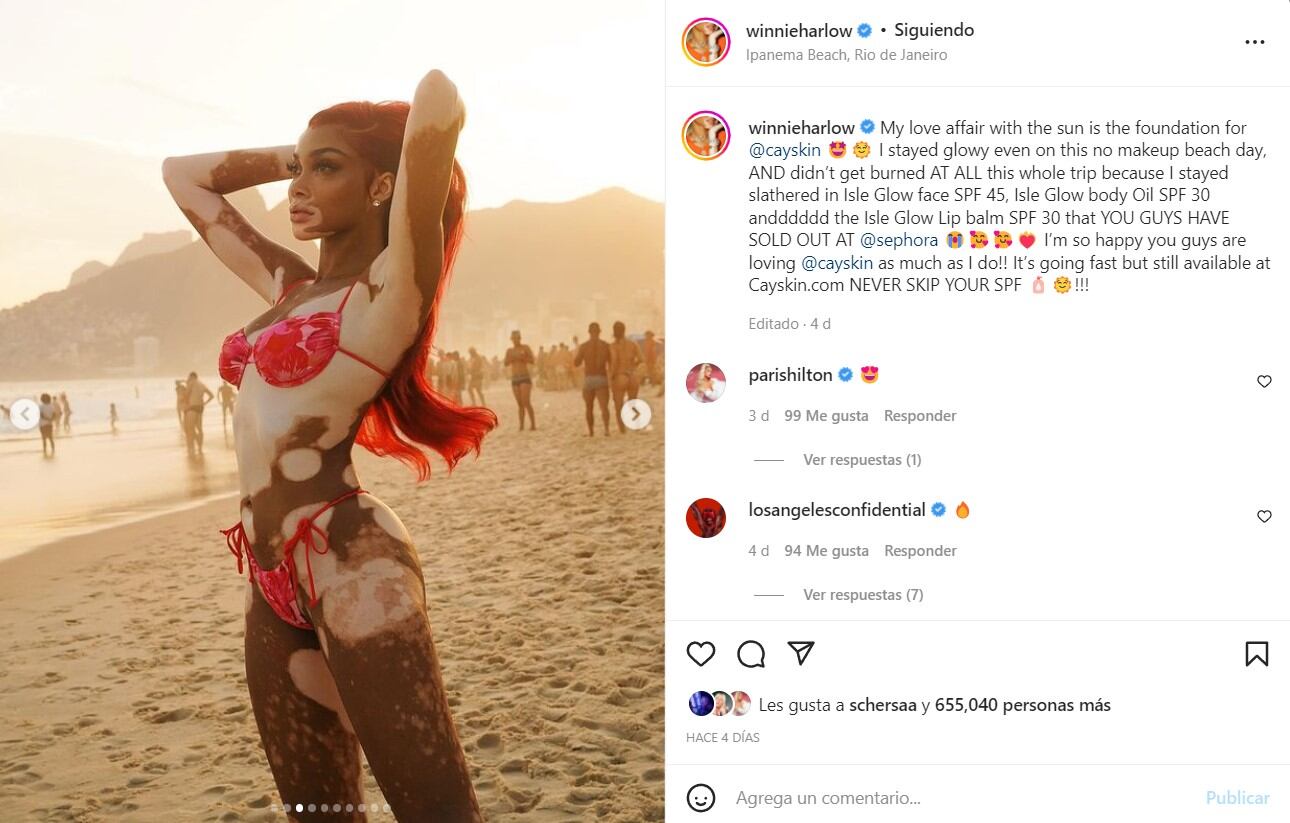 Winnie Harlow luce su increíble figura con mini bikini en la playa de Brasil