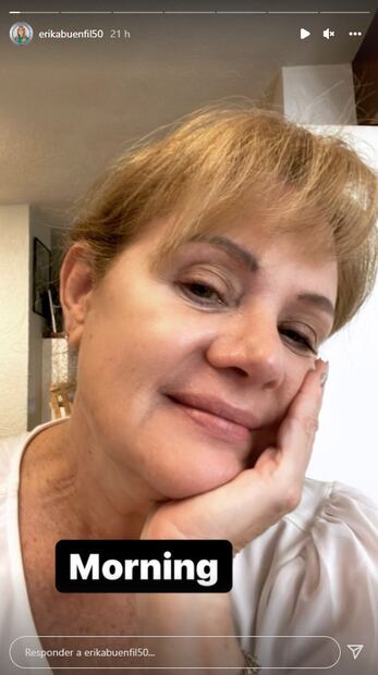 Érika Buenfil enseña su cuerpo en una foto en bikini de antes y después