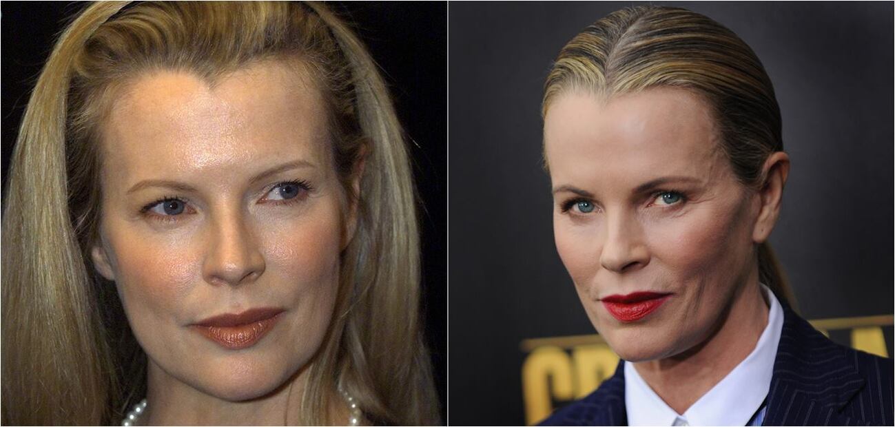 Las actrices de los 90 que se cambiaron el rostro 