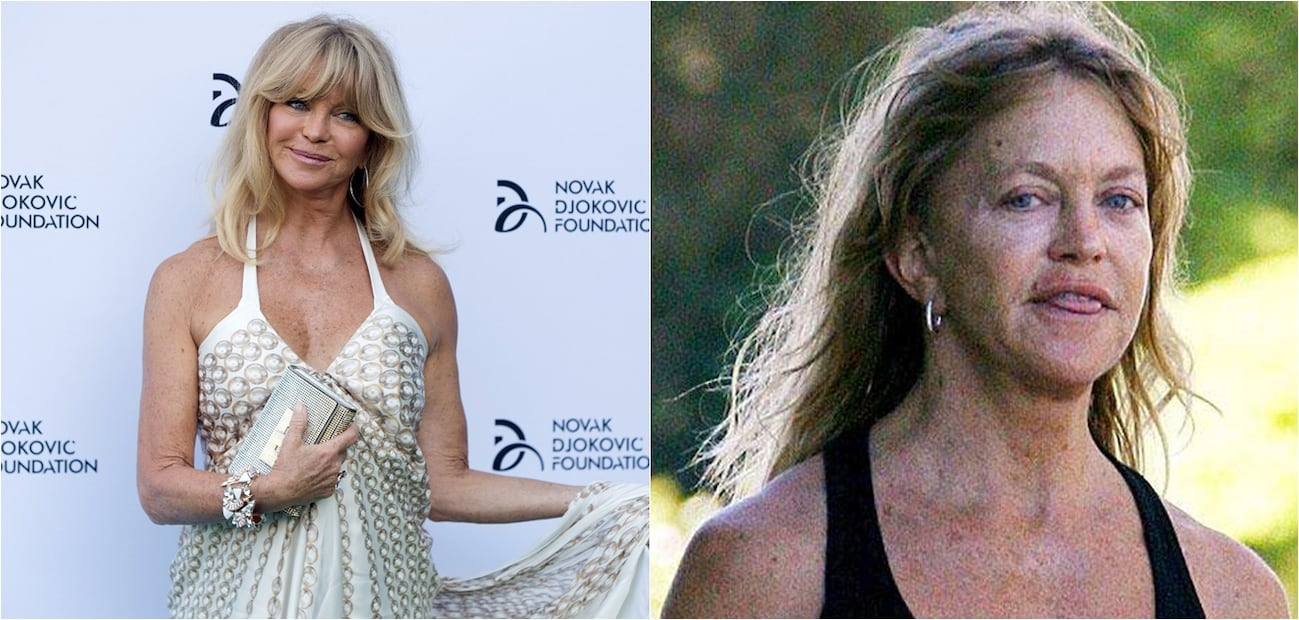 Las peores fotos de las celebridades