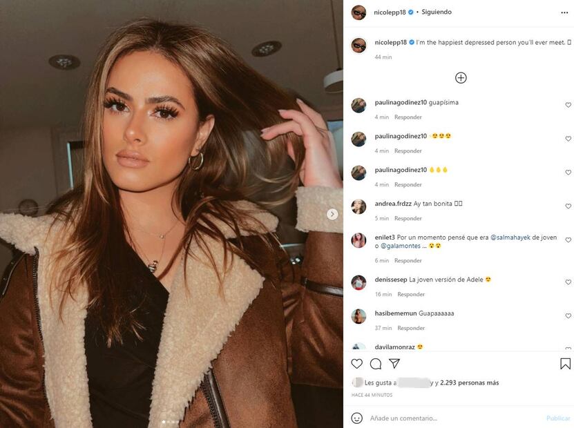 ¿Qué se hizo Nicole Peña en la cara? Su impactante transformación ¡luce guapísima!