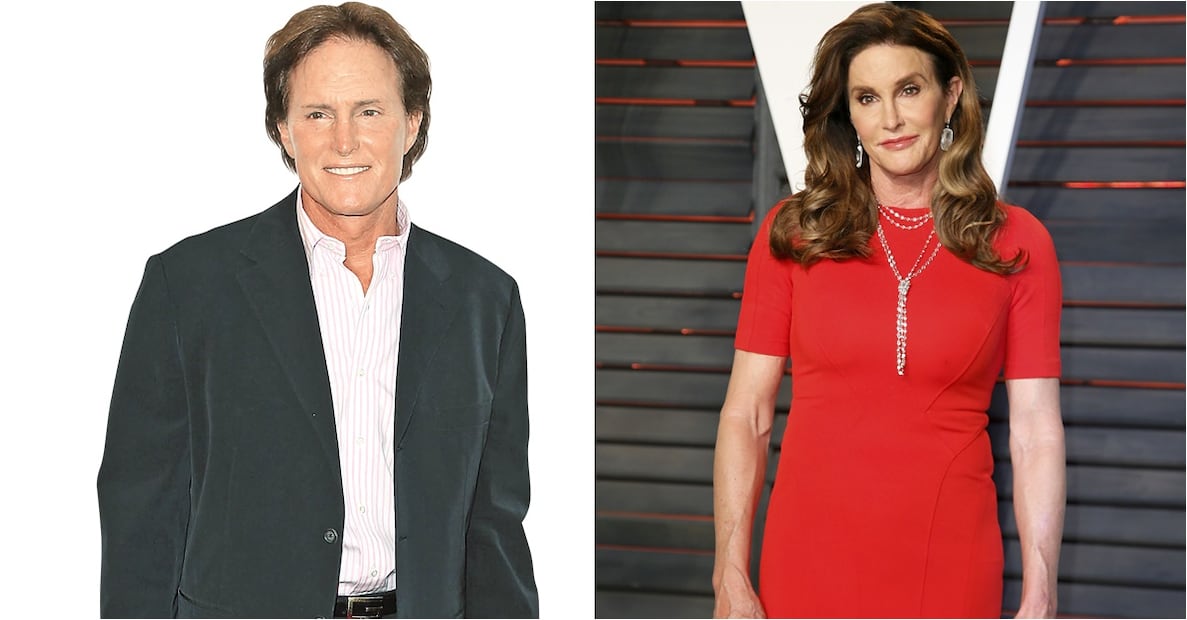 Las Kardashian antes y después del quirófano