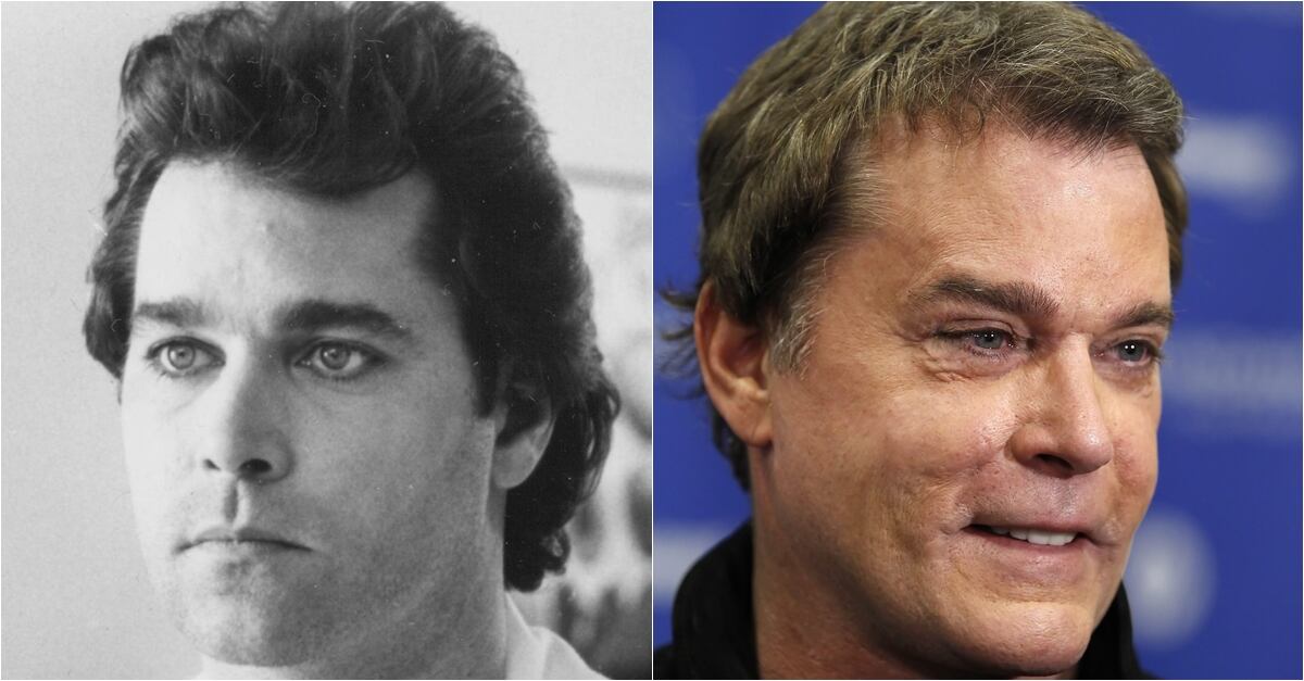 Famosos que cambiaron por completo sus rostros con cirugías o bótox