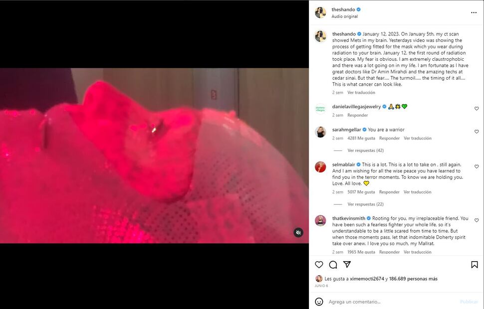 Shannen Doherty compartió un video de su tratamiento de radiación / Instagram