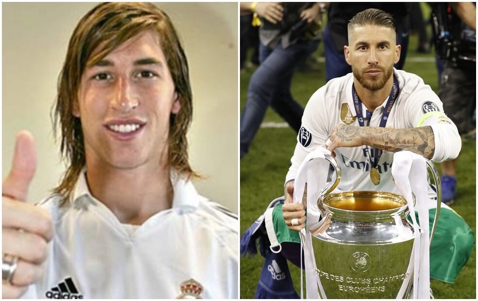FOTOS: Antes y después de futbolistas que se operaron el rostro