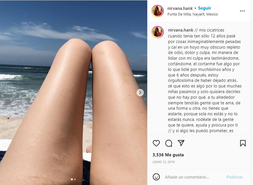 Nirvana Hank habla sincera sobre sus autolesiones: "Terminé tocando fondo"