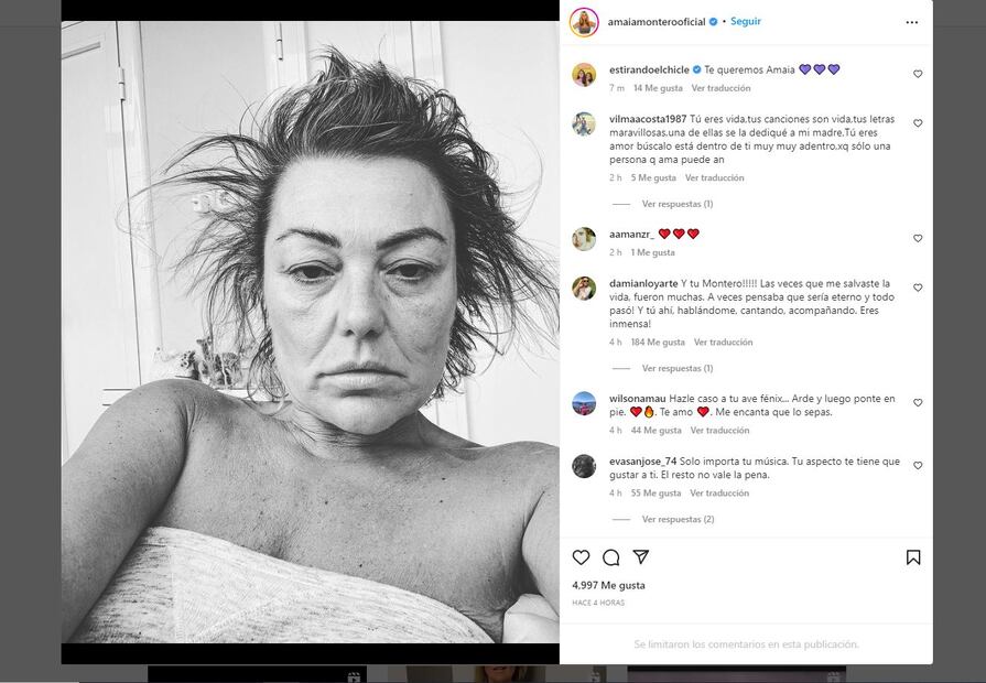 Amaia Montero, de  La Oreja de Van Gogh, enciende las alarmas por su aspecto
