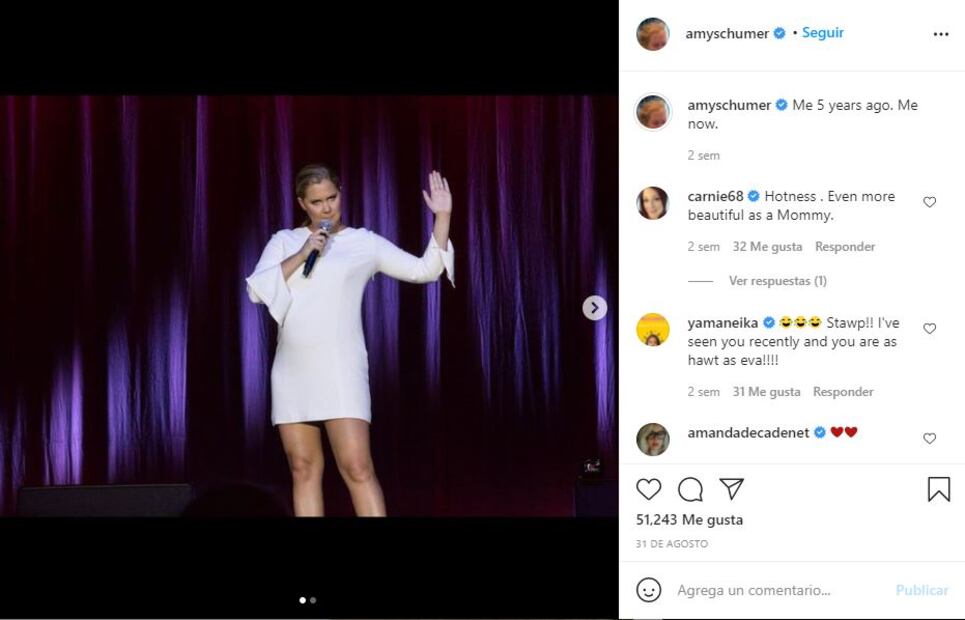 Amy Schumer revala que le extirparon el útero por una edometriosis
