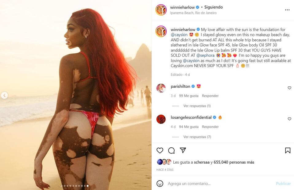 Winnie Harlow luce su increíble figura con mini bikini en la playa de Brasil