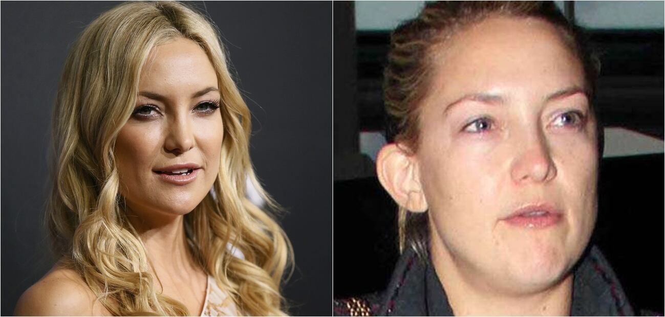 Las peores fotos de las celebridades