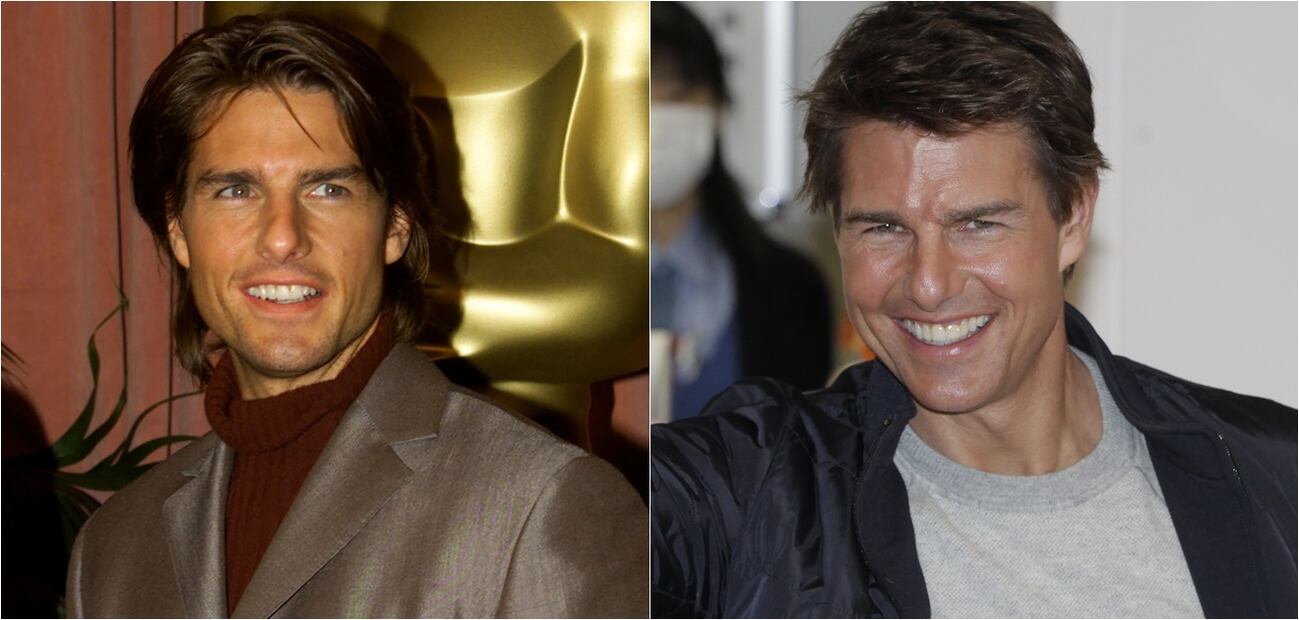 Famosos que tienen dientes postizos y no sabías