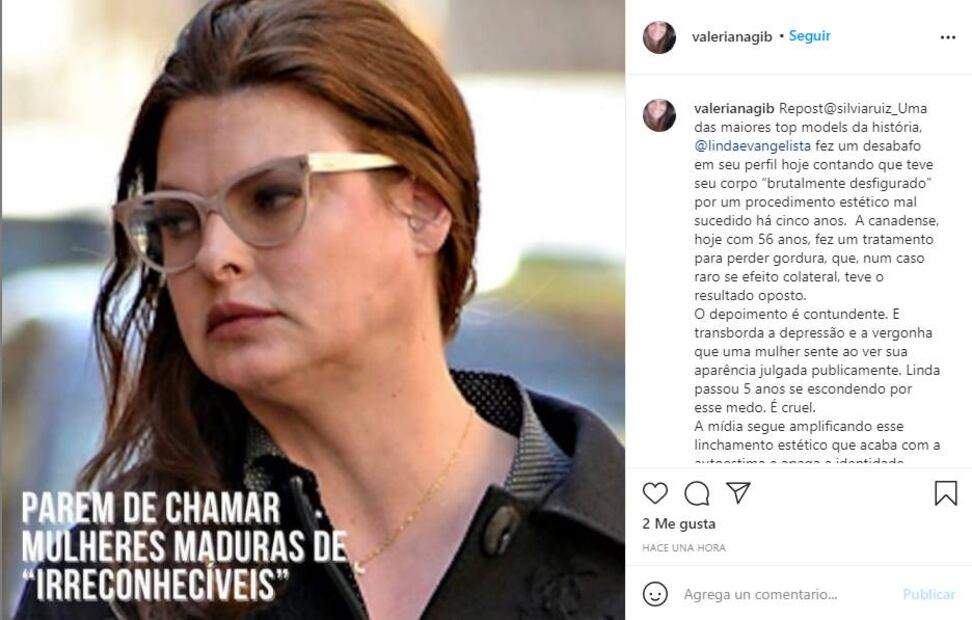 Linda Evangelista, "brutalmente desfigurada" tras someterse a un tratamiento estético