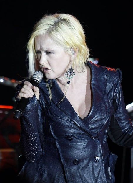 Cindy Lauper regresa con "Hope" después de 3 años de ausencia por psoriasis