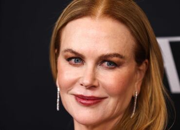Nicole Kidman, blanco de críticas por la apariencia de su cara, ¿irreconocible?