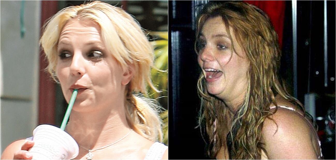 Las peores fotos de las celebridades