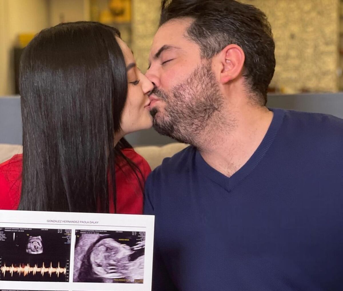 La pareja ha compartido este proceso en sus redes sociales / Foto: Instagram