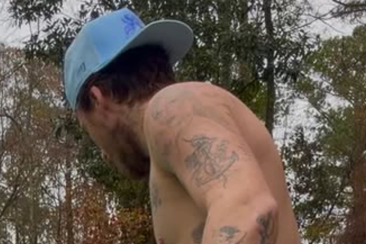 Brooklyn Beckham elimina 'DAD' de su tatuaje / Foto: Instagram