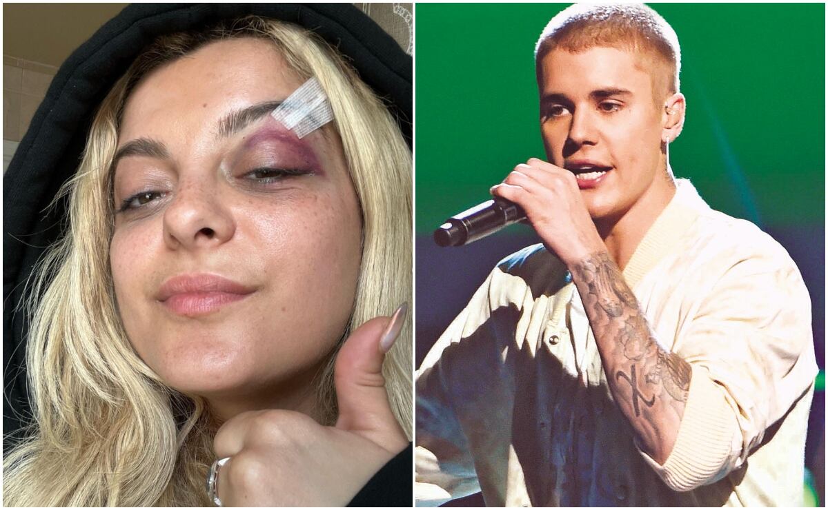 Bebe Rexha y más celebridades golpeadas por fans en el escenario