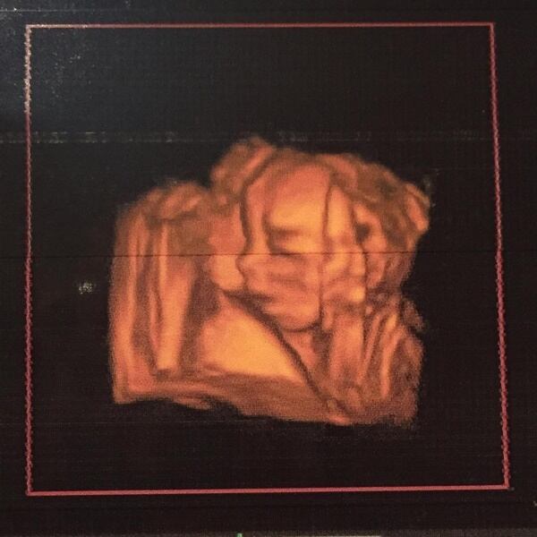 Jacky Bracamontes luce bikini a unos días de dar a luz