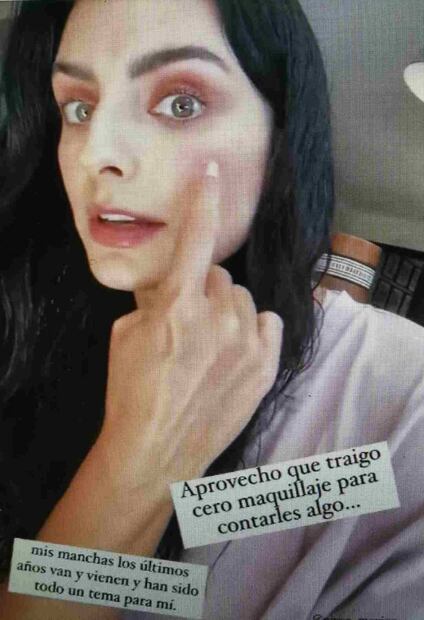 Aislinn Derbez se muestra sin maquillaje y habla del paño que tiene desde el embarazo