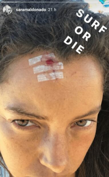 FOTOS: Así quedó Sara Maldonado tras sufrir accidente 