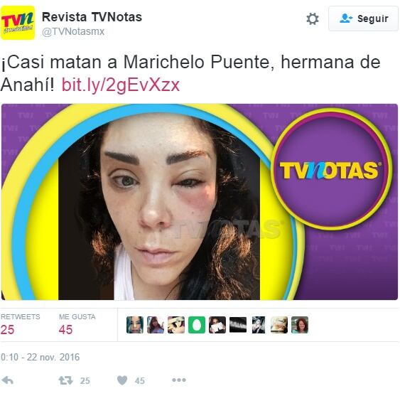 Famosas que pusieron en riesgo su salud por tratamientos estéticos