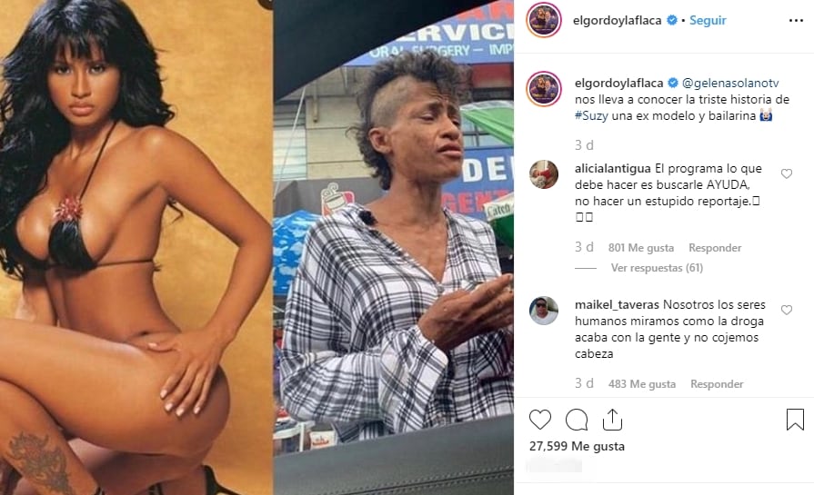 La impactante historia de Suzy Pérez, ex bailarina de Jennifer Lopez