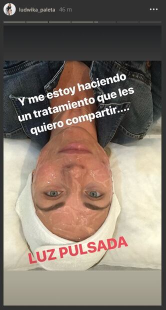 Ludwika Paleta revela que padece un problema dermatológico 