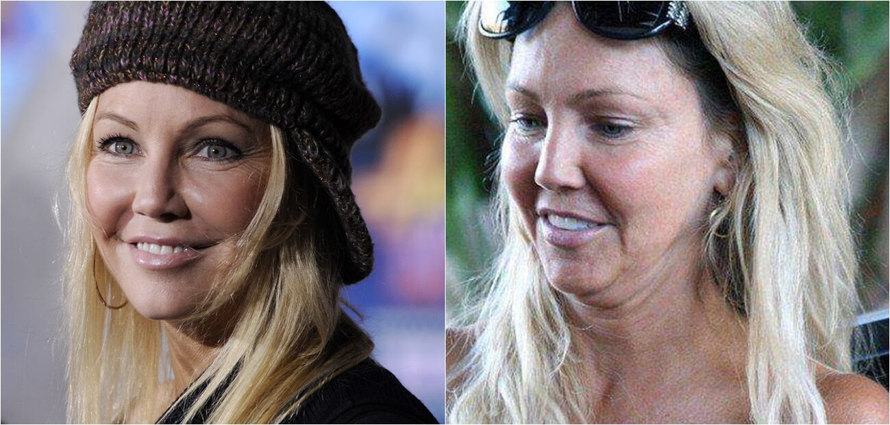 Las peores fotos de las celebridades