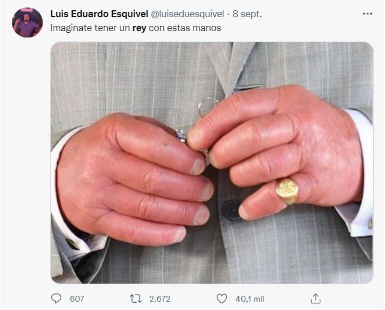 ¿Por qué el rey Carlos III tiene los dedos tan hinchados?
