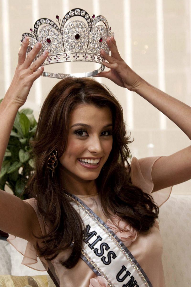 Las cirugías de las reinas de belleza