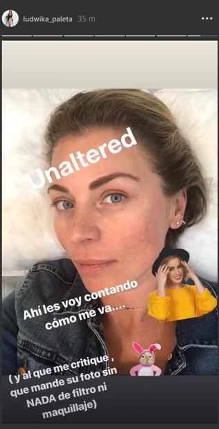 Ludwika Paleta revela que padece un problema dermatológico 