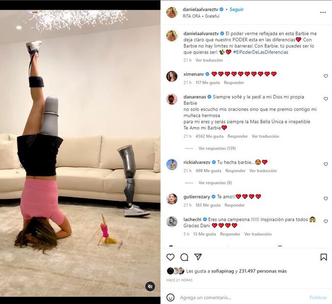 Daniela Álvarez muestra a su Barbie que también tiene una prótesis