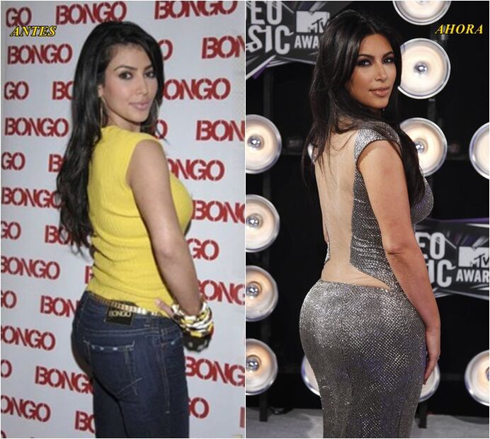 Las fotos que prueban que Kim Kardashian no tenía curvas 
