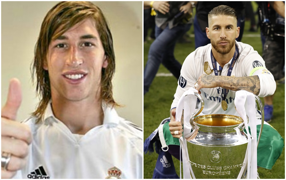FOTOS: Antes y después de futbolistas que se operaron el rostro | Clase